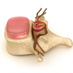 図２ 椎骨の１つ　椎間板と脊髄の関係が見える。 